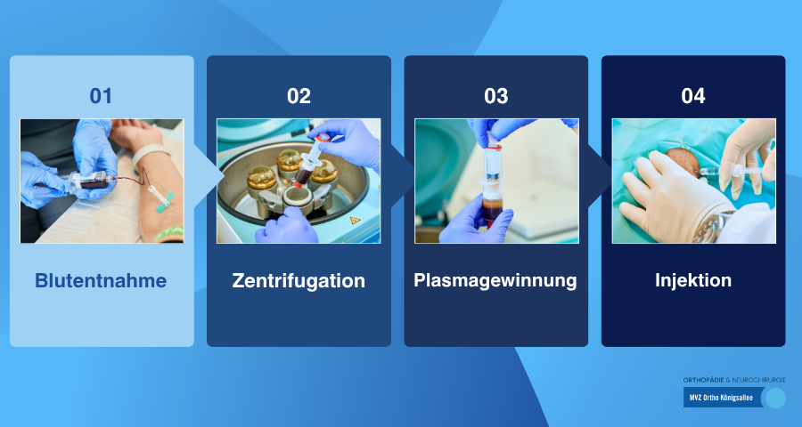 Ablauf einer ACP Therapie Düsseldorf 4 Schritte