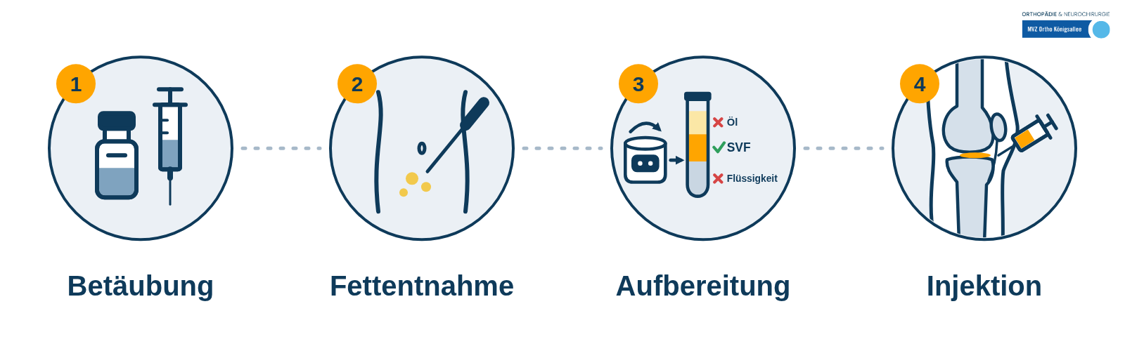 Ablauf der SVF Stammzelltherapie mit Betäubung, Fettabnahme, Aufbereitung und Injektion