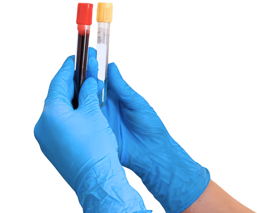 Eigenbluttherapie Orthopädie Königsallee Düsseldorf 