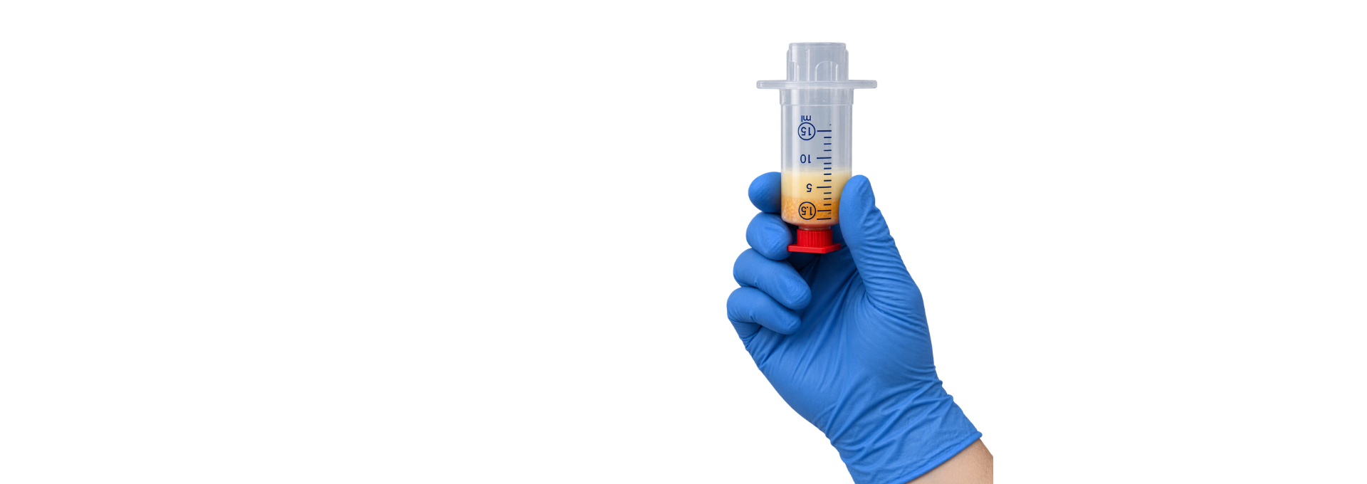 SVF Stammzellterhapie Spritze mit Fettzellen